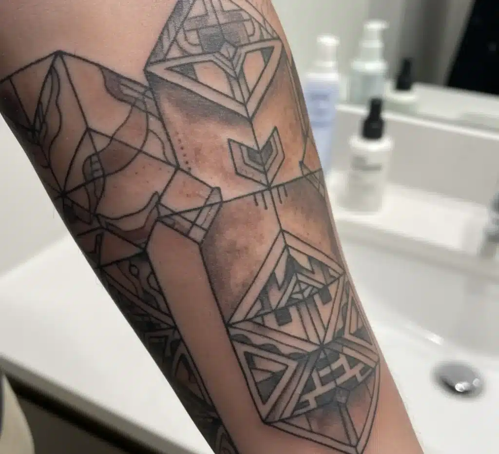 Can tattoos cause hyperpigmentation?