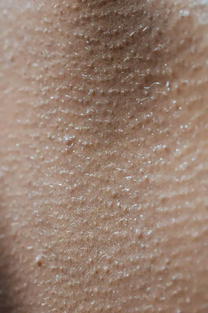 What Facial to Get for Sensitive Skin?