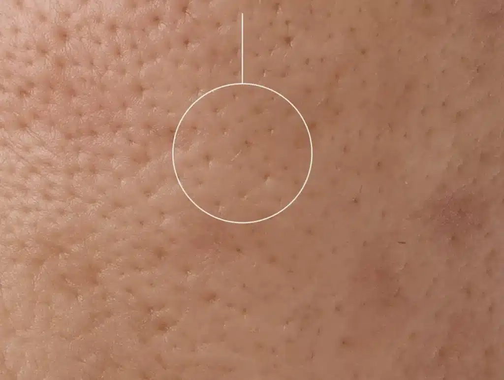 best foundation for dry skin