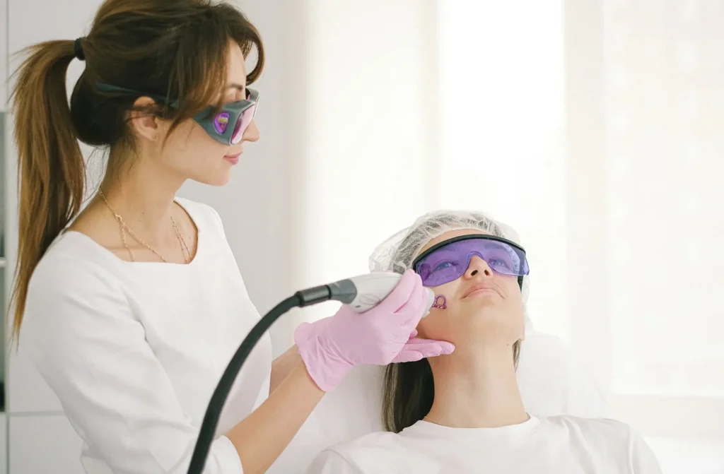 candela laser pigmentation removal