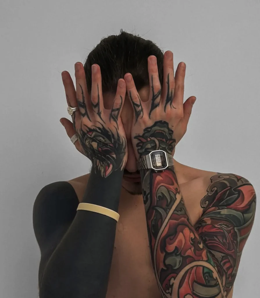 does tattoo removal scar