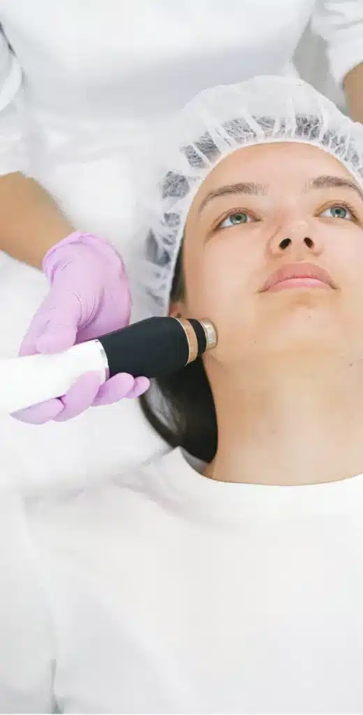 microneedling vs skin needling