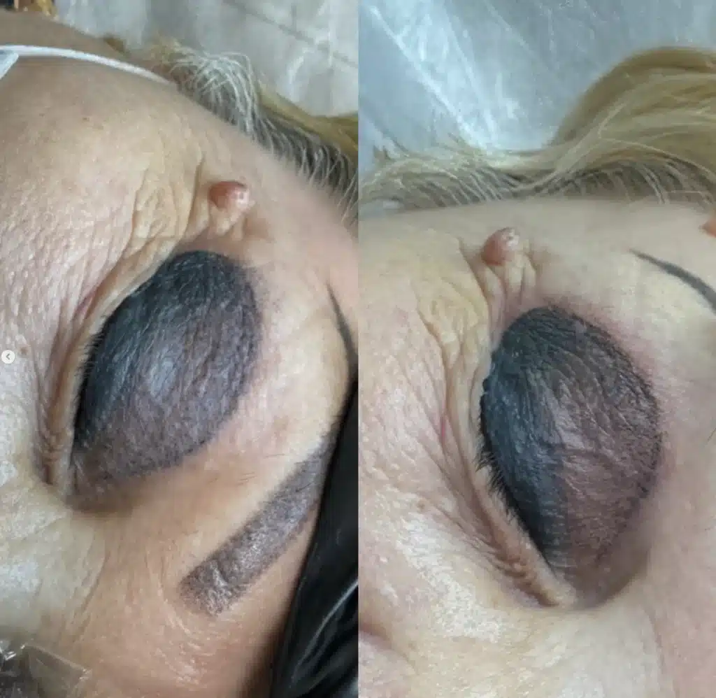 permanent makeup gone wrong