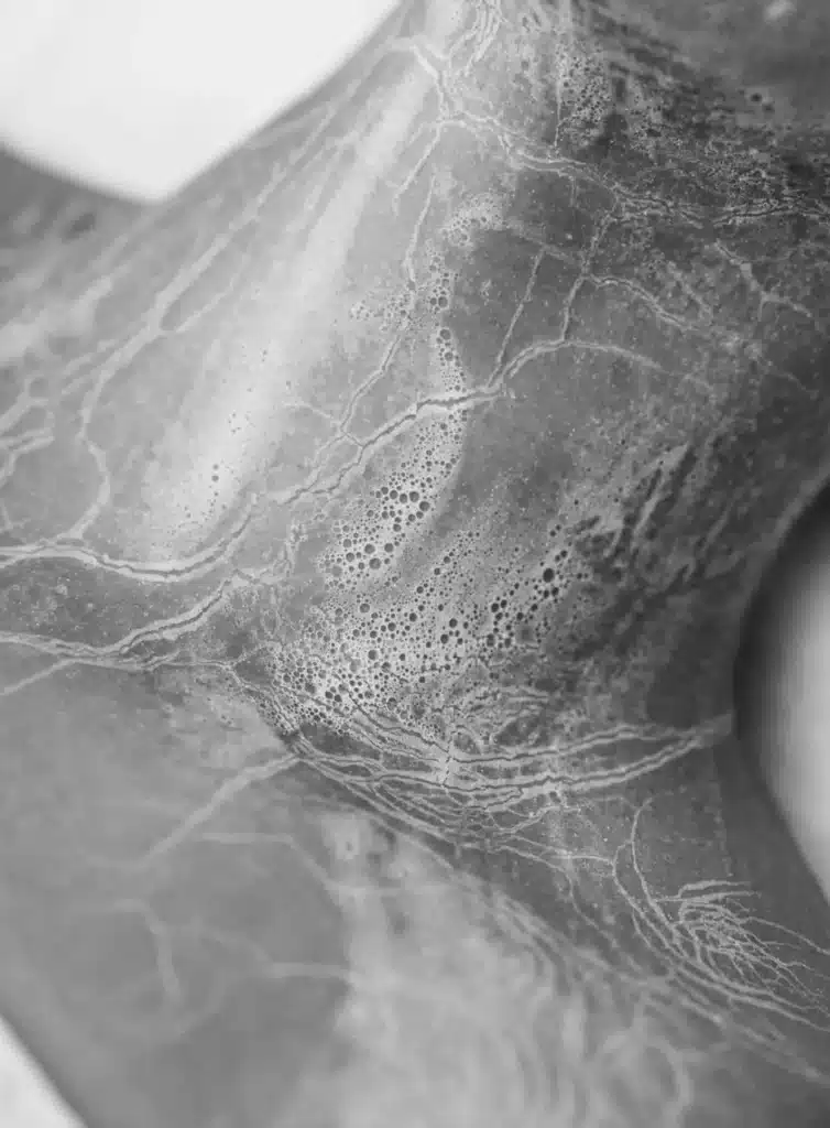 skin preparation before cosmetic procedure